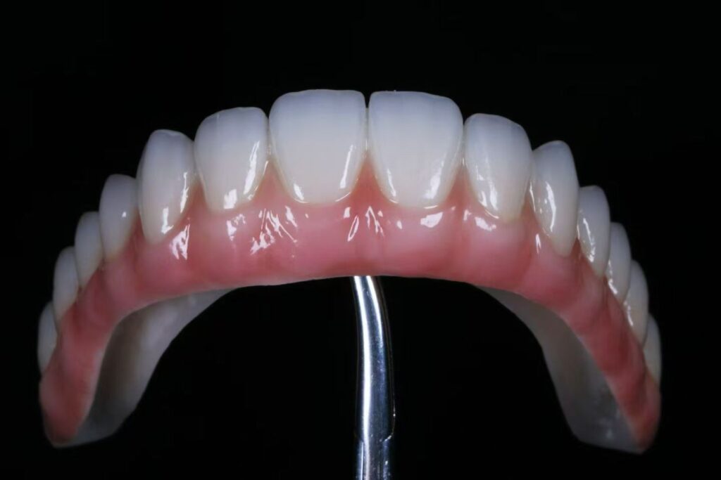 China Dental Lab Dental Lab China