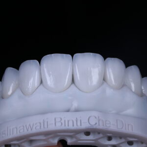 zirconia crown&bridge