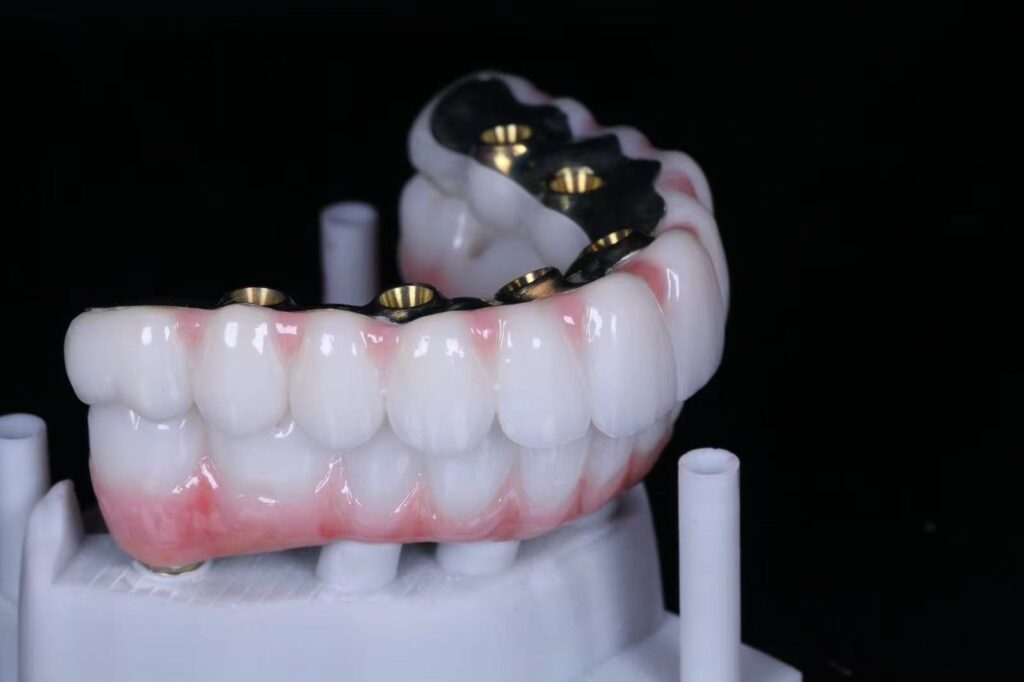 China Dental Lab Dental Lab China Implant crown&Bridge Implant All on X