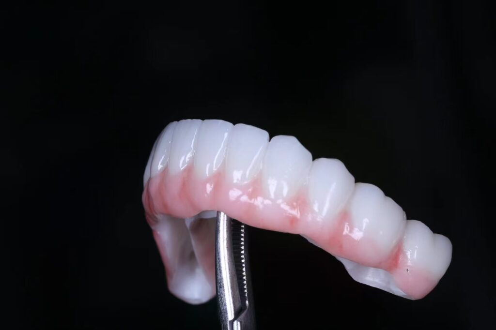 China Dental Lab Dental Lab China Implant crown&Bridge Implant All on X