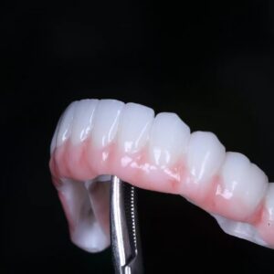 China Dental Lab Dental Lab China Implant crown&Bridge Implant All on X