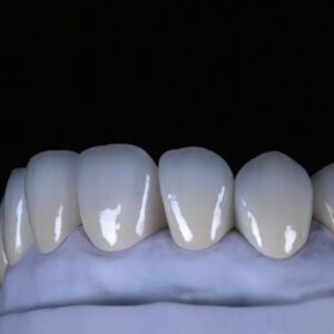 Quality and esthetics – The esthetic appearance of the material is comparable to that of IPS e.max lithium disilicate – High strength, stability and durability and a wide variety of applications – Easy placement with conventional cements or self-adhesive luting materials Our Zirconia has versatile uses and is characterized by outstanding quality and superb esthetics.-China Dental Lab Dental Lab China zirconia crowns and bridge