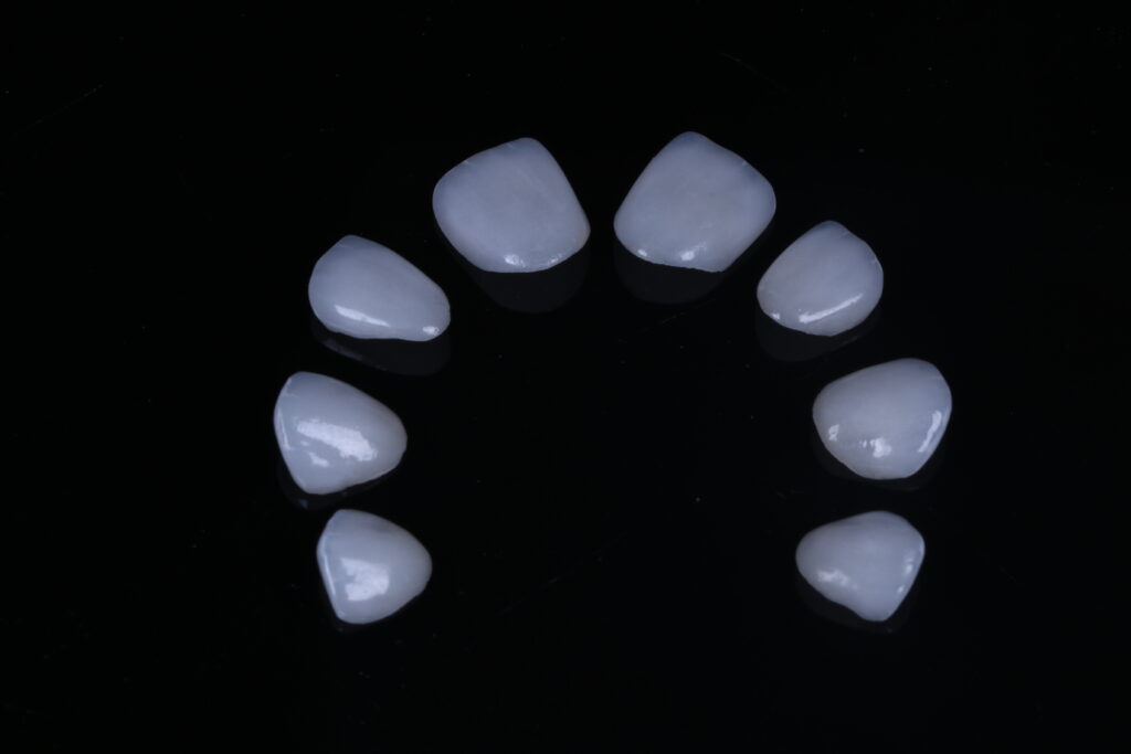 China Dental Lab Dental Lab China zirconia crowns and bridge 