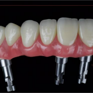 China Dental Lab Dental lab China Best dental lab in China