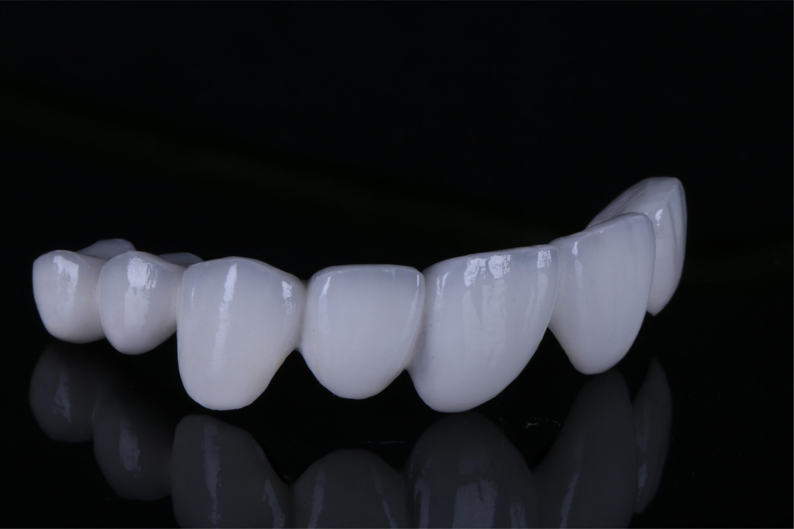 AMD Dental Lab: High-End Digital Restorations & Global Excellence